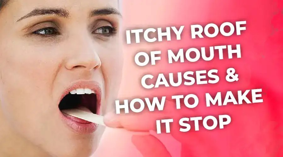 Itchy Roof of Mouth Causes & How to Make It Stop