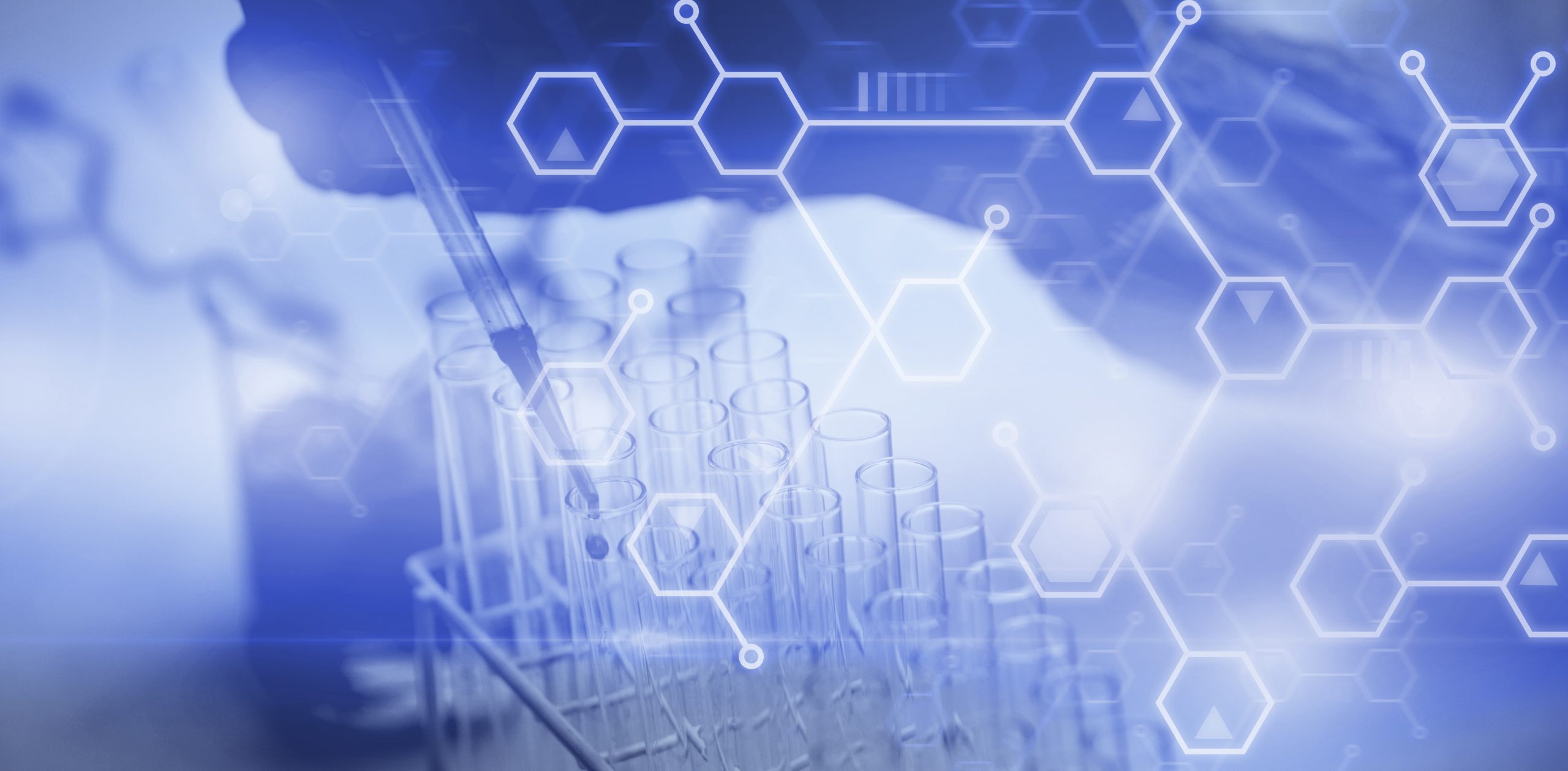 TruSteel automated extraction and processing equipment