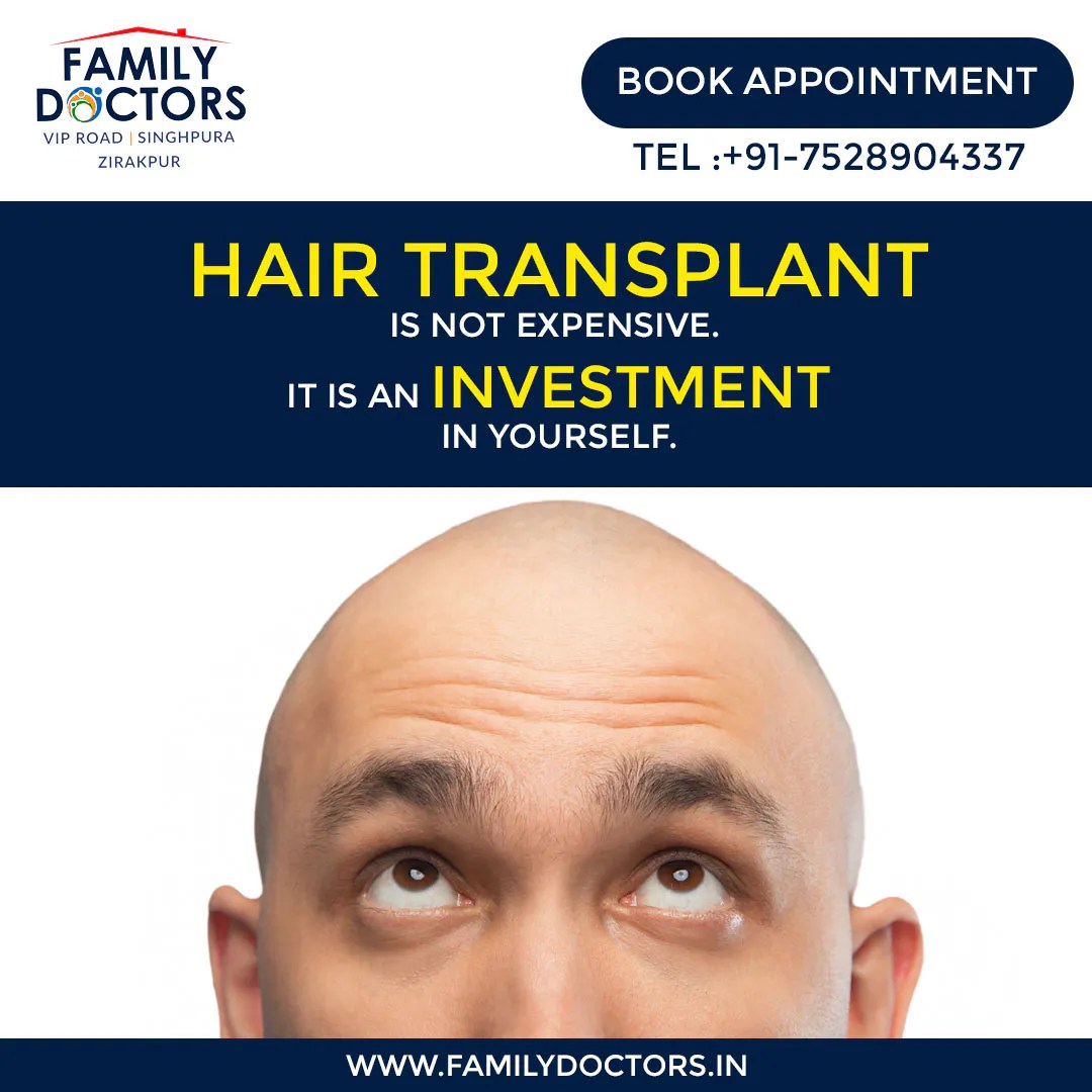 Family Doctors Hair Transplant in Zirakpur PRP Treatment FUT