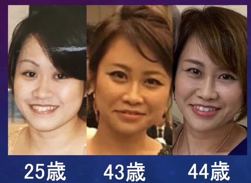 人相占い】口の大きさと口角の形で見る性格診断5タイプ【顔相】 | 占い＆マジック株式会社D-World どうしても下がってしまう口角にはボトックス | 西田美穂のボトックスマニア