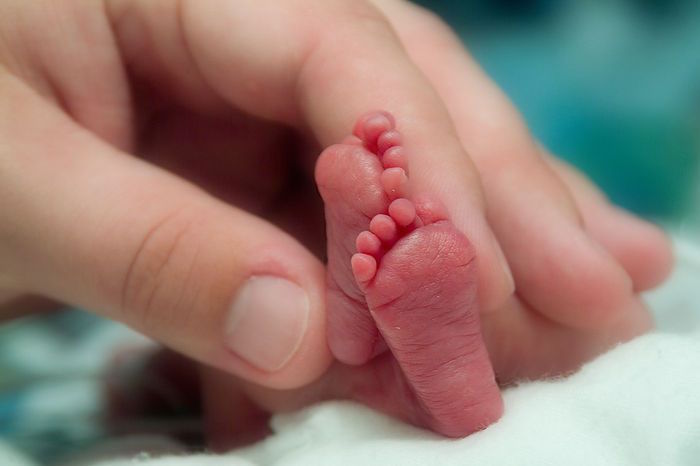Un bebé prematuro nació dentro del saco amniótico intacto TvCrecer