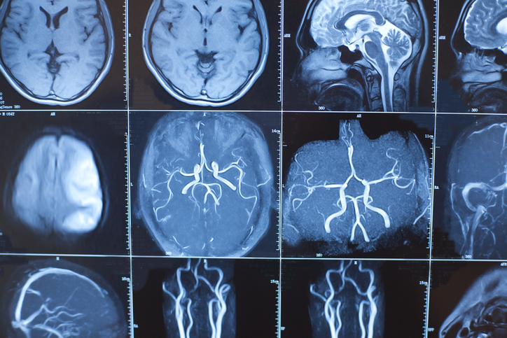 Costs And Prices Of Angiograms | Two Views