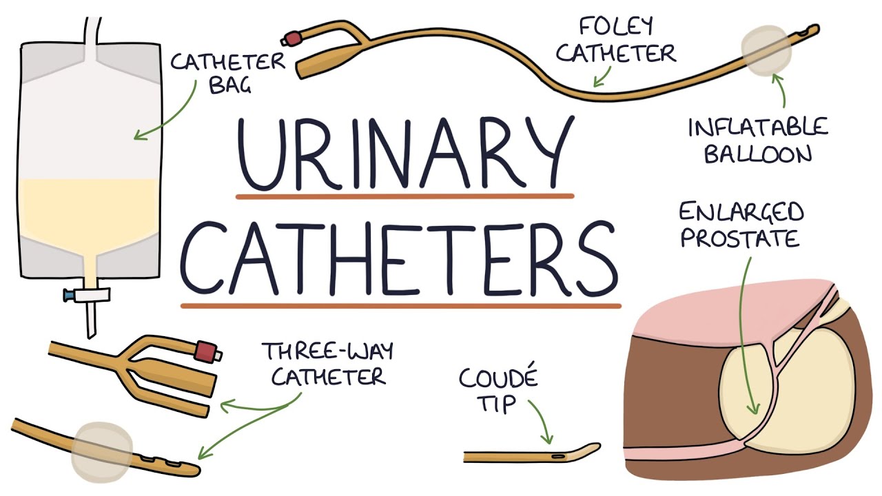 Urinary Catheters TwtBit