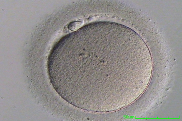 IVF Process Step by Step Egg Retrieval Embryo Transfer Austin IVF