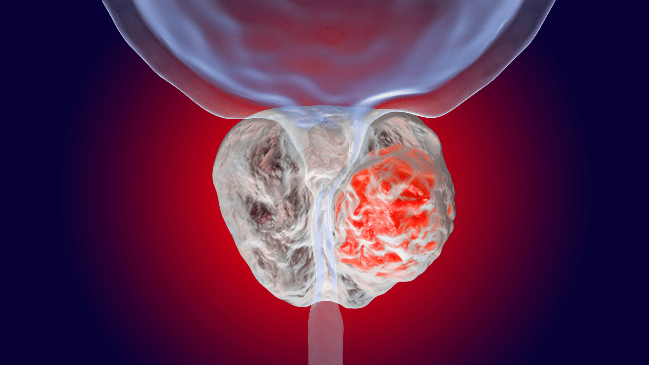 Everything You Want to Know About Male Incontinence TYE Medical