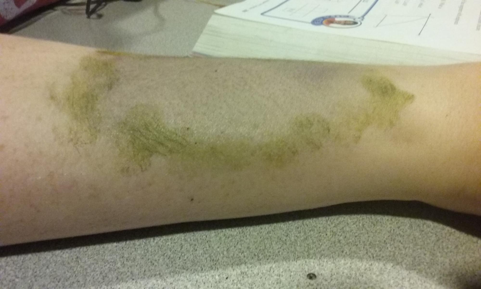 Special Effects MakeUp Bruises U32 Chronicle