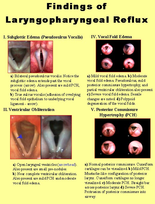 Laryngopharyngeal reflux