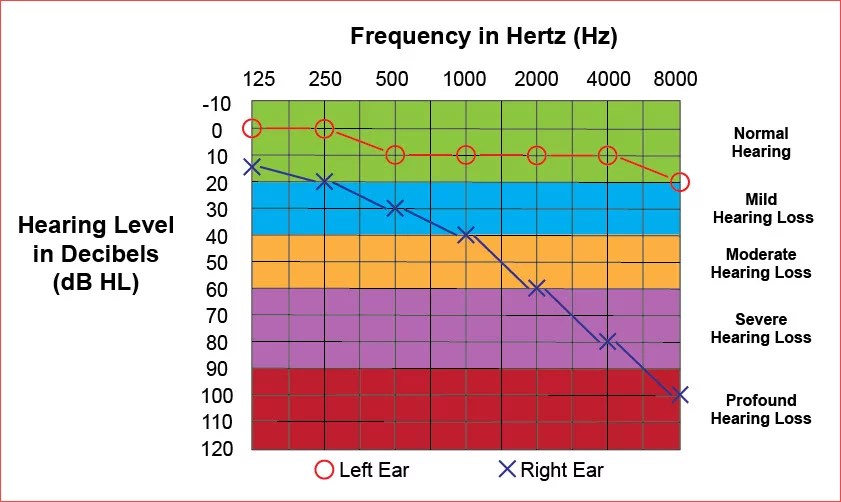 Hearing Tests Audiometry and Audiogram Colorado UCHealth