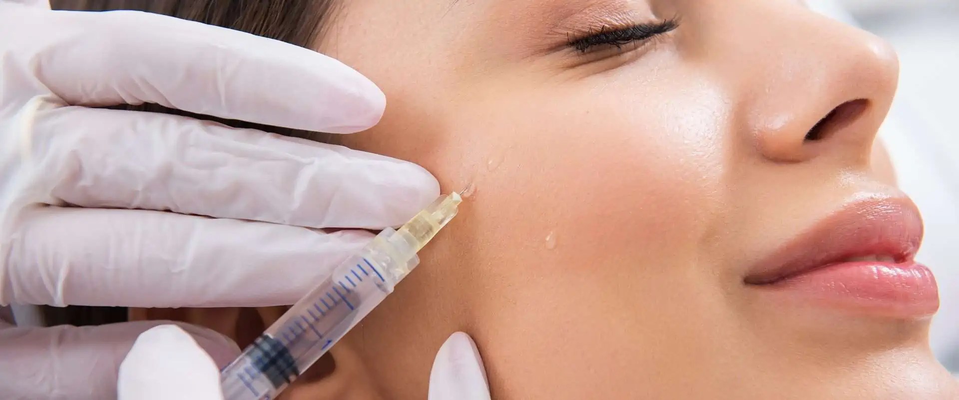 Aumento de pómulos sin cirugía en Mallorca Udemax