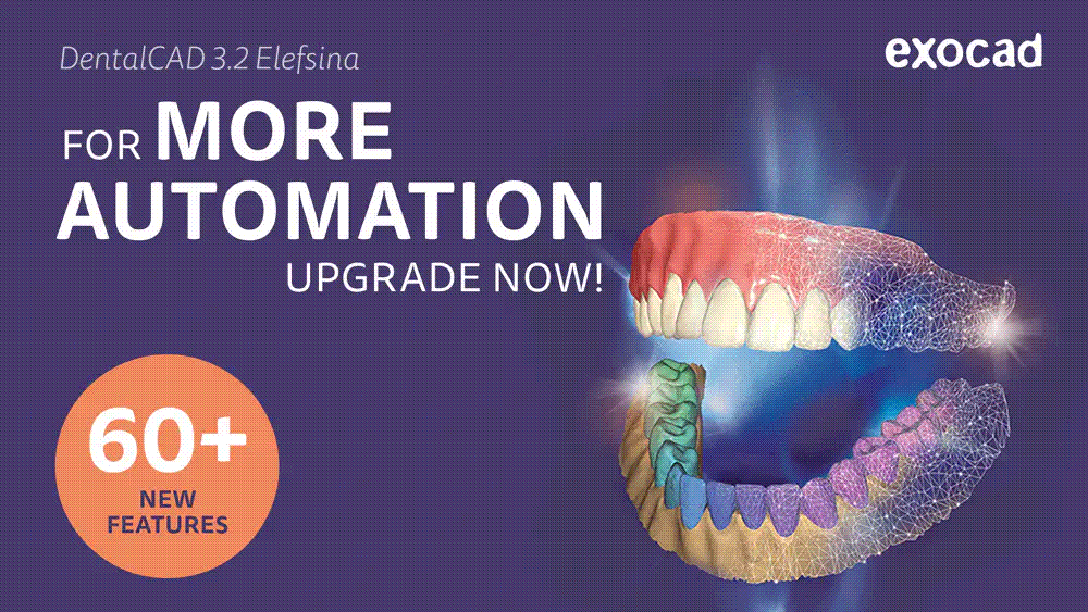 exocad DentalCAD® 3.2 Elefsina New Release is Out Now! Unique Dental