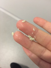 Warning Tmi Pics* Thick Weird Yellow Colour Discharge | Mumsnet