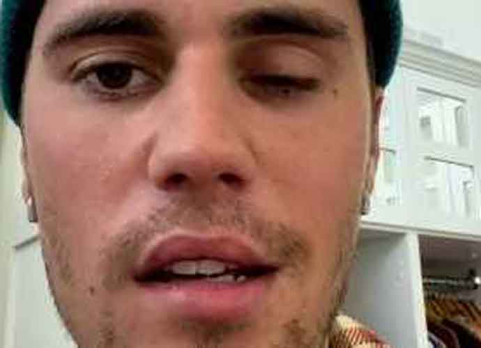 Justin Bieber Reveals He Has Facial Paralysis From Ramsay Hunt Syndrome