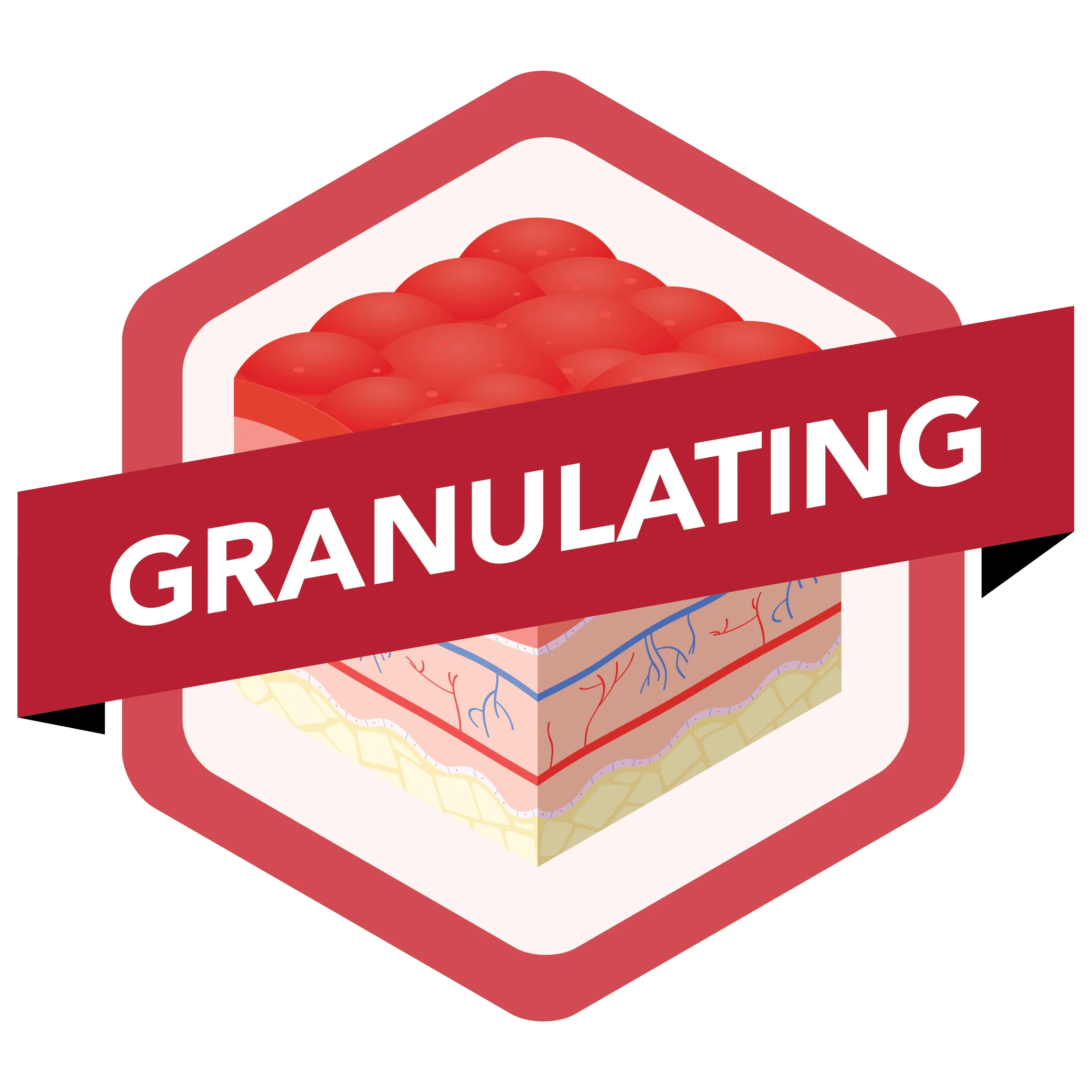 Wound Guide Granulating Advancis Medical