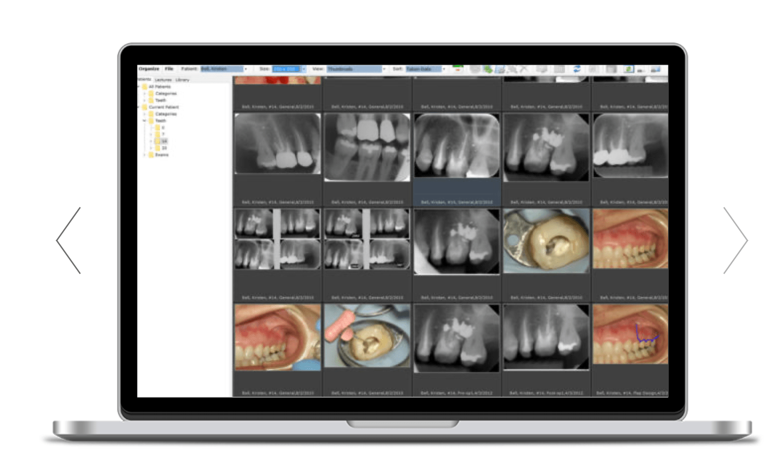 Technology Ultra Endodontics