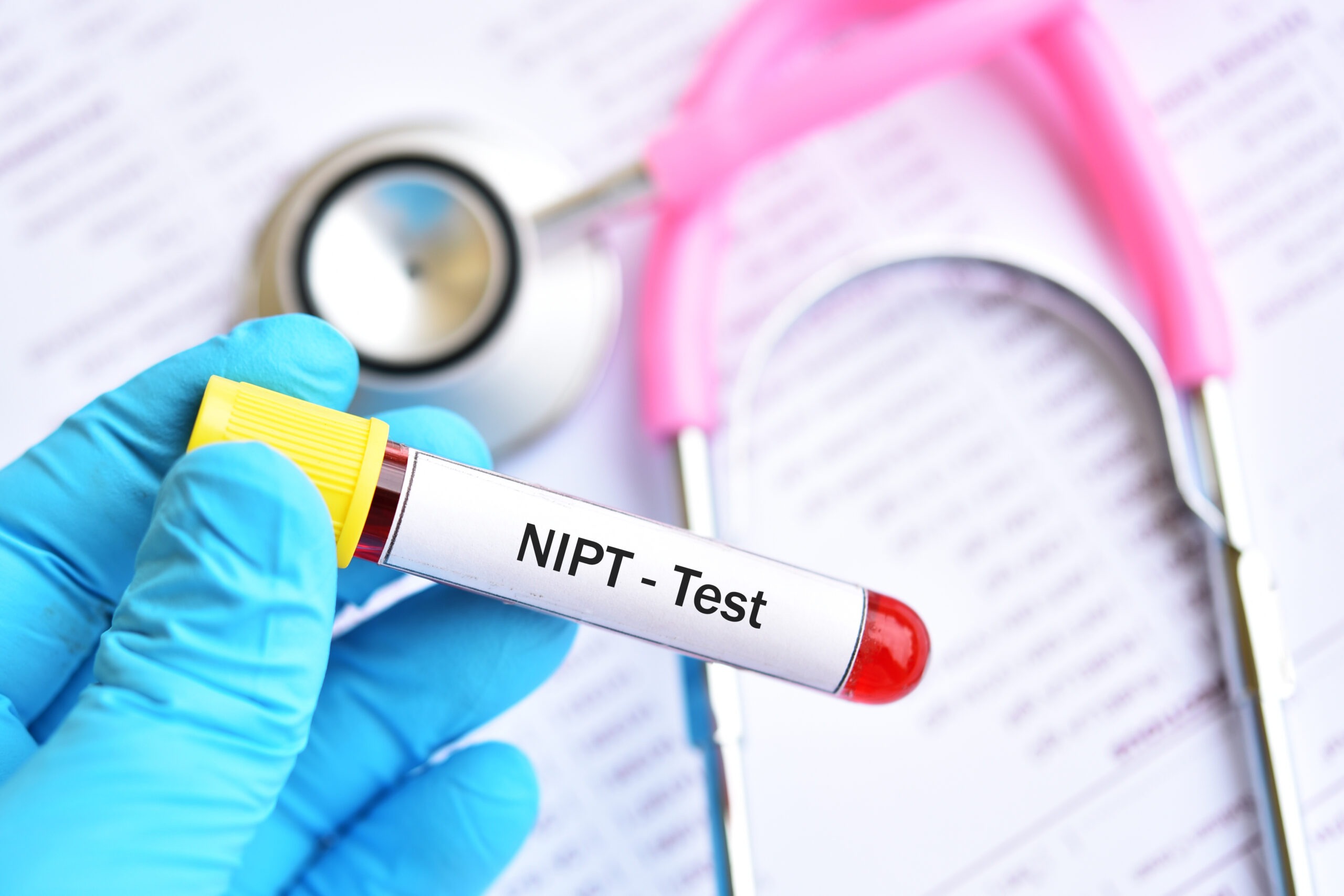 Everything You Need To Know About A NIPT Test Ultrasound Plus