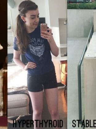 Photos of Michelle in three stages: hypothyroid, hyperthyroid, and stable.