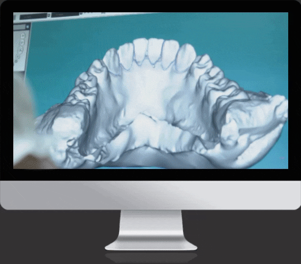 Universal Orthodontic Laboratory Fullservice custom orthodontic lab