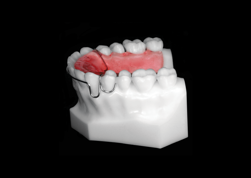Standard Hawley Retainer (Upper) Universal Orthodontic Lab