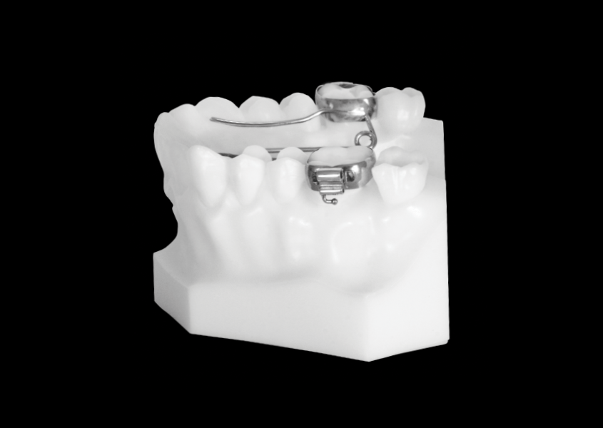 Quad Helix (Upper) Universal Orthodontic Lab
