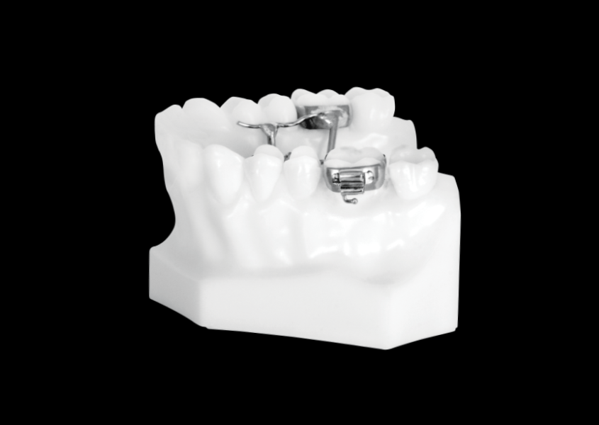 Rapid Palatal Expander (Upper) Universal Orthodontic Lab