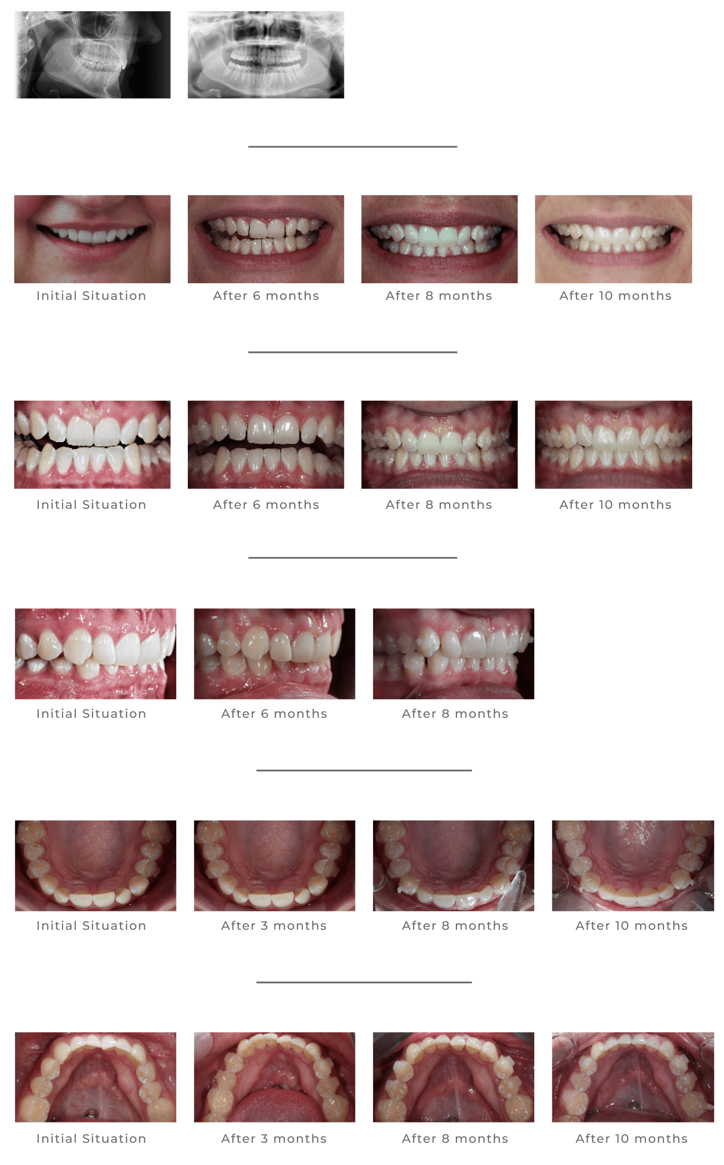 Case Studies Universal Orthodontic Lab