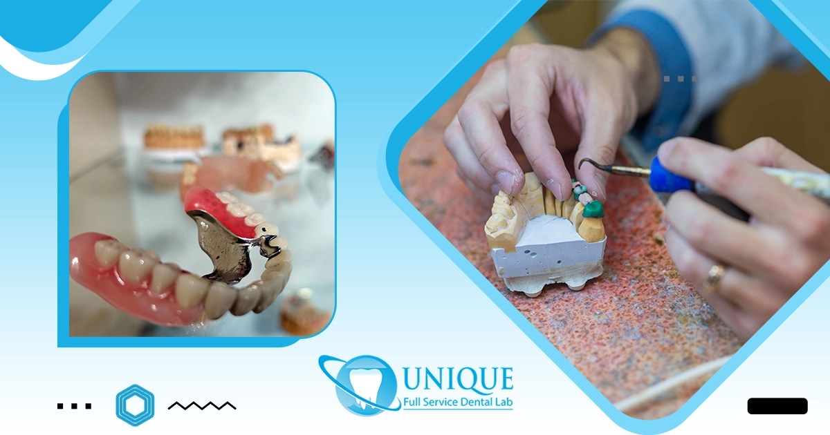 Exploring Different Materials Used in Dentures. Blog