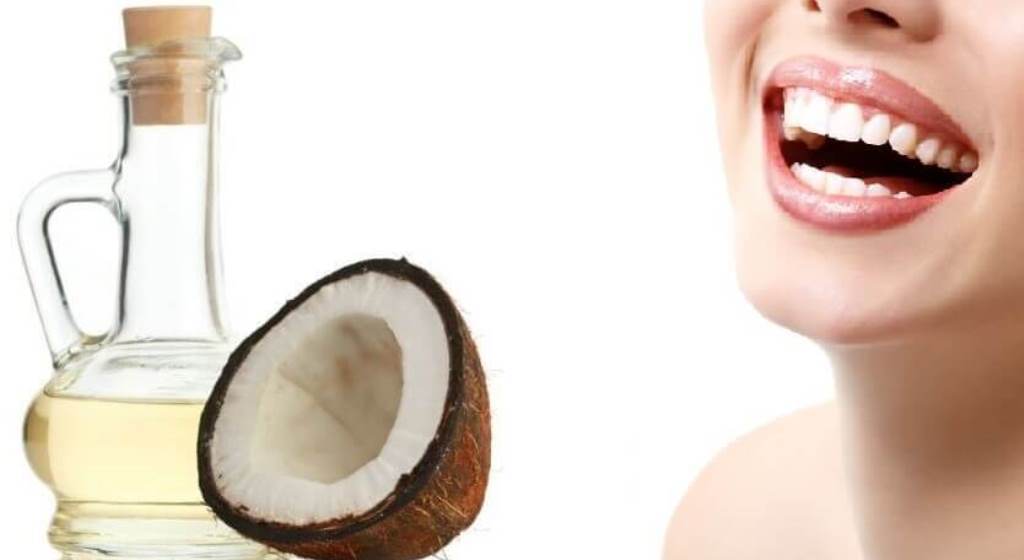 Blanqueamiento dental desde casa,¿Es posible? Dentistas Por Chile