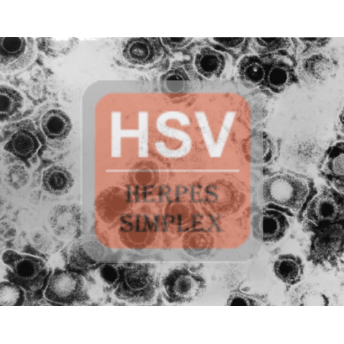 Herpes Simplex Virus (1, 2) Antibody (mAb) Mouse HSVMM01 United
