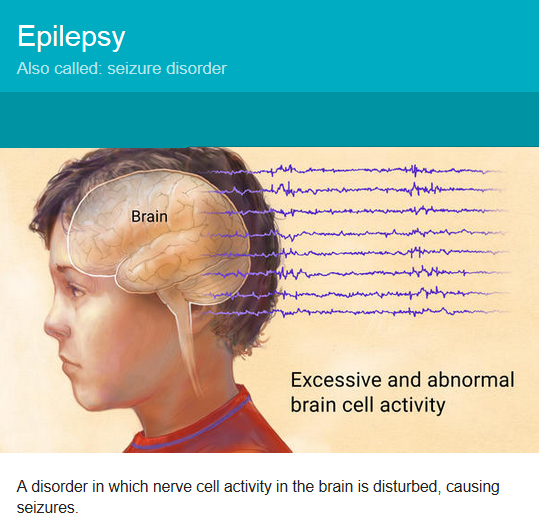 Epilepsy Medical Alert Bracelets Universal Medical Data