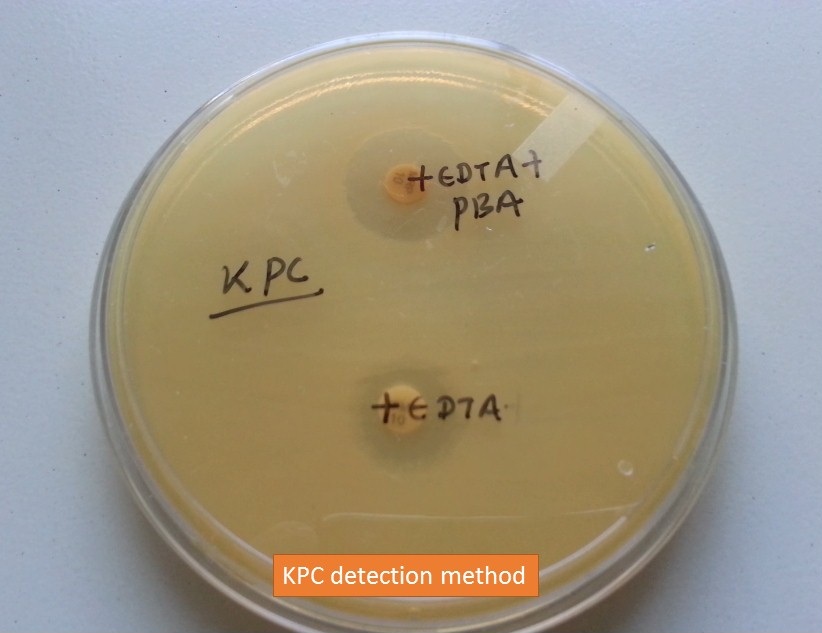 Klebsiella pneumoniae carbapenemases (KPC) Introduction, Importance