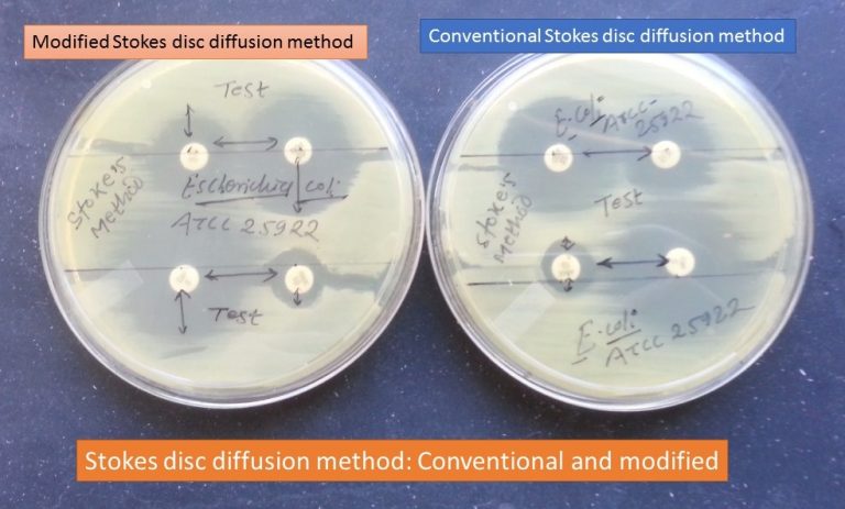 Stokes Method Introduction,Types, Principle, Procedure and Result Interp