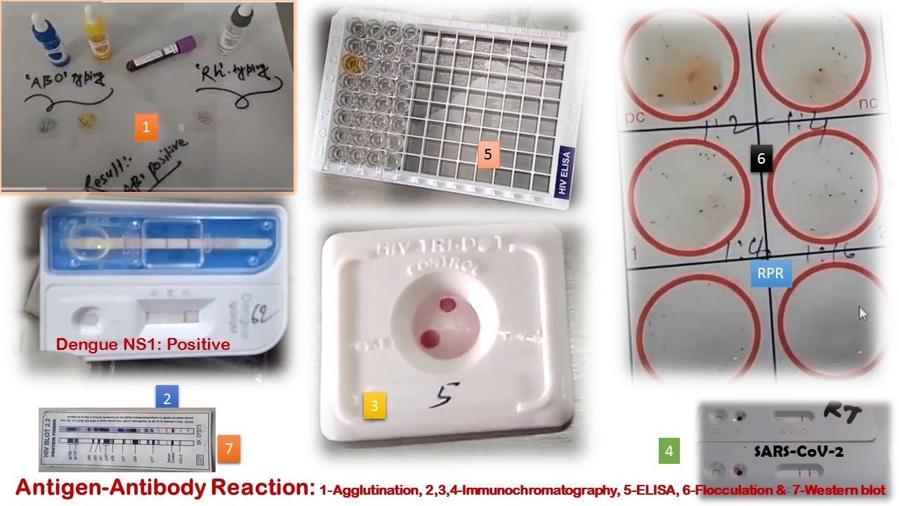 AntigenAntibody Reaction Based Tests Introduction, Types with Descripti