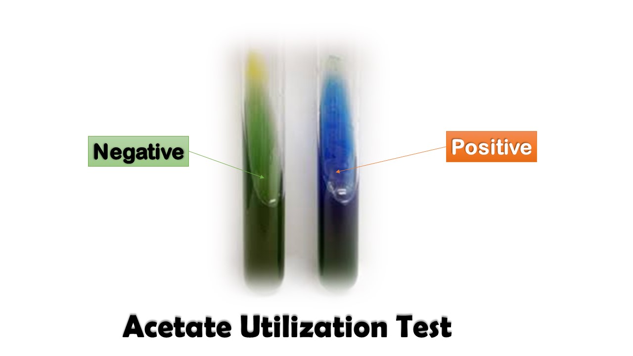 Acetate Utilization Test Introduction, Principle, Test Requirements