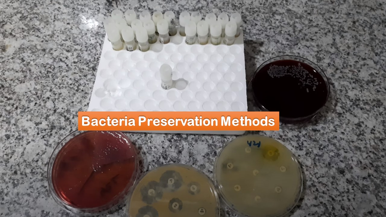 Bacteria Preservation Introduction, Storage methods, Common Procedure