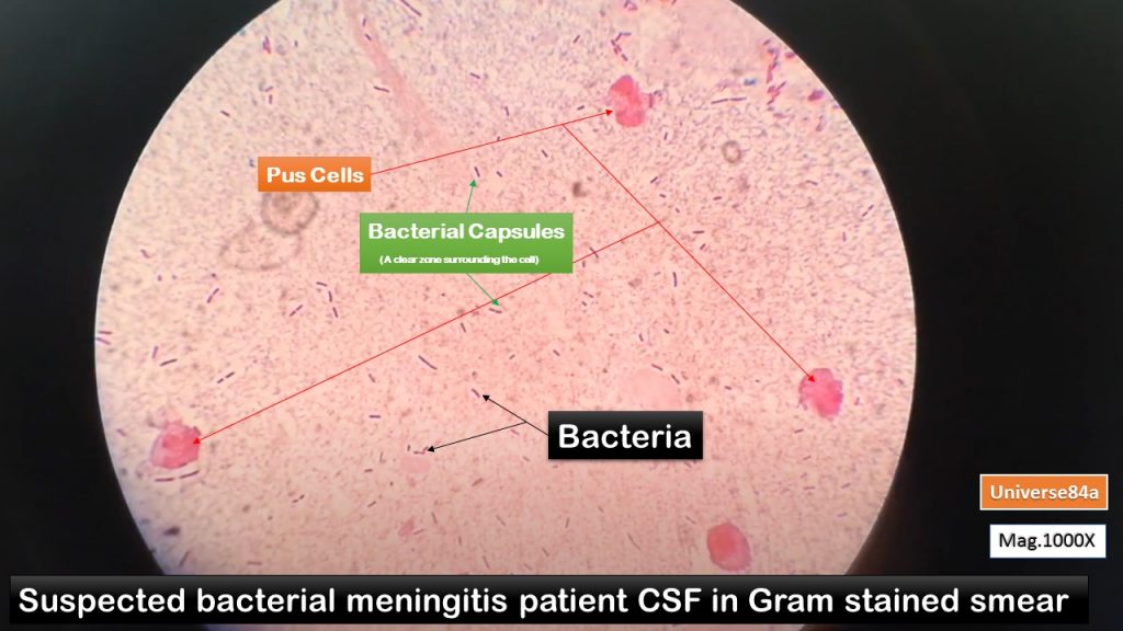 Bacterial Capsule Demonstration Using Negative Staining Method Introdu