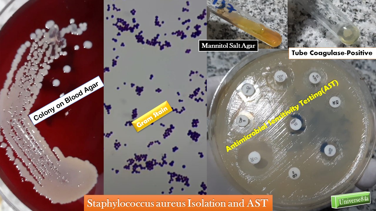 Staphylococcus Introduction, Classification, Pathogenecity, Lab Diagnosis,