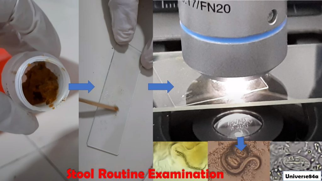 Stool Routine Examination Introduction, Techniques, Testing Requireme
