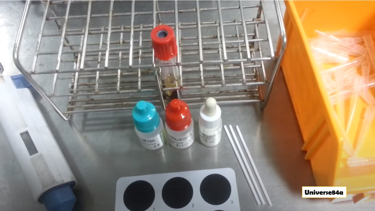 CReactive Protein (CRP) Test Introduction, Principle, Testing Procedure