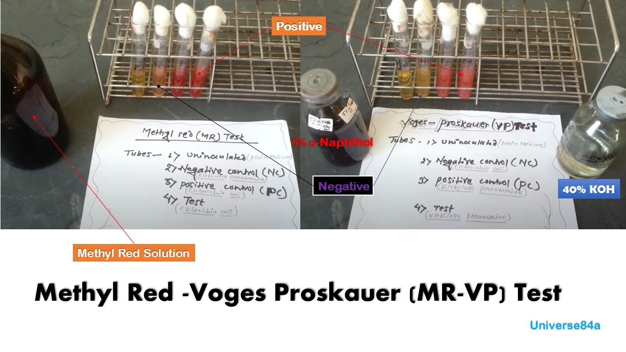 MRVP Test Introduction, Principle, Procedure, Result Interpretation