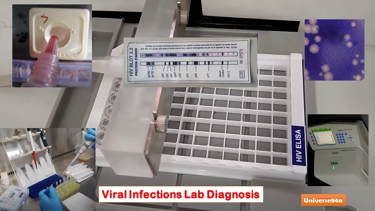 Viral Infections Lab Diagnosis Introduction, List of Common Virus