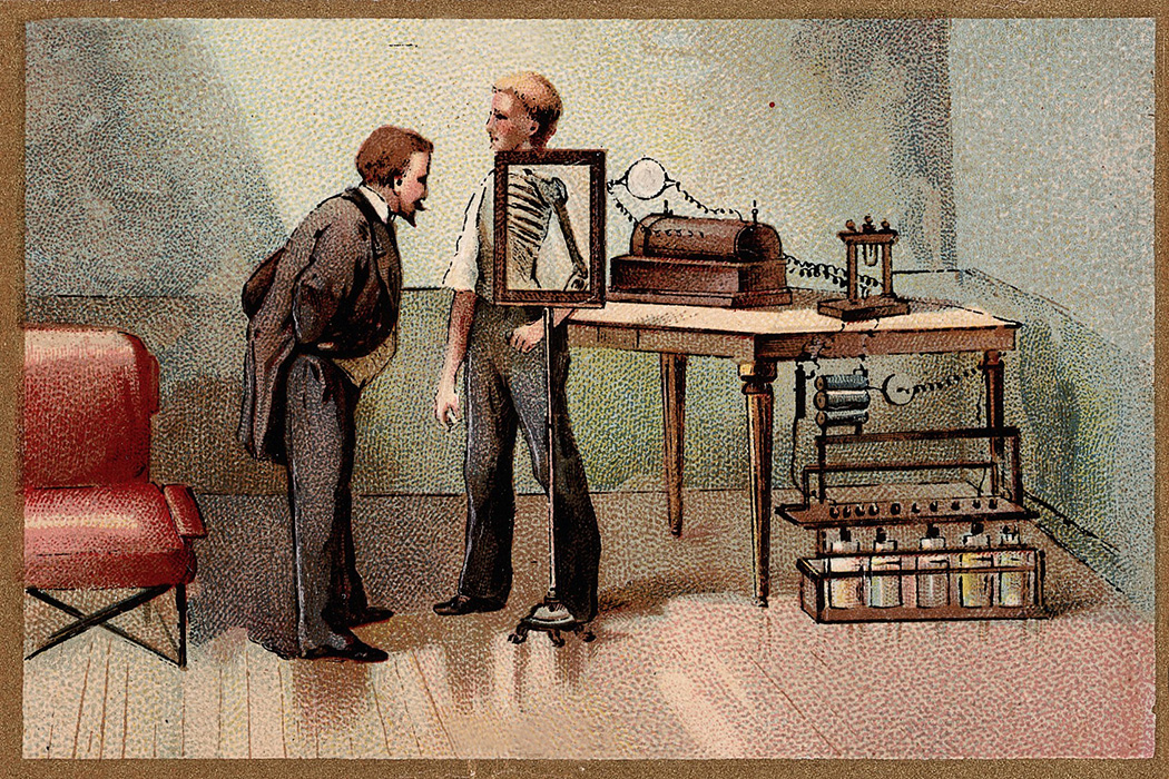 The History of Xray Uni Xray 2023 Updated