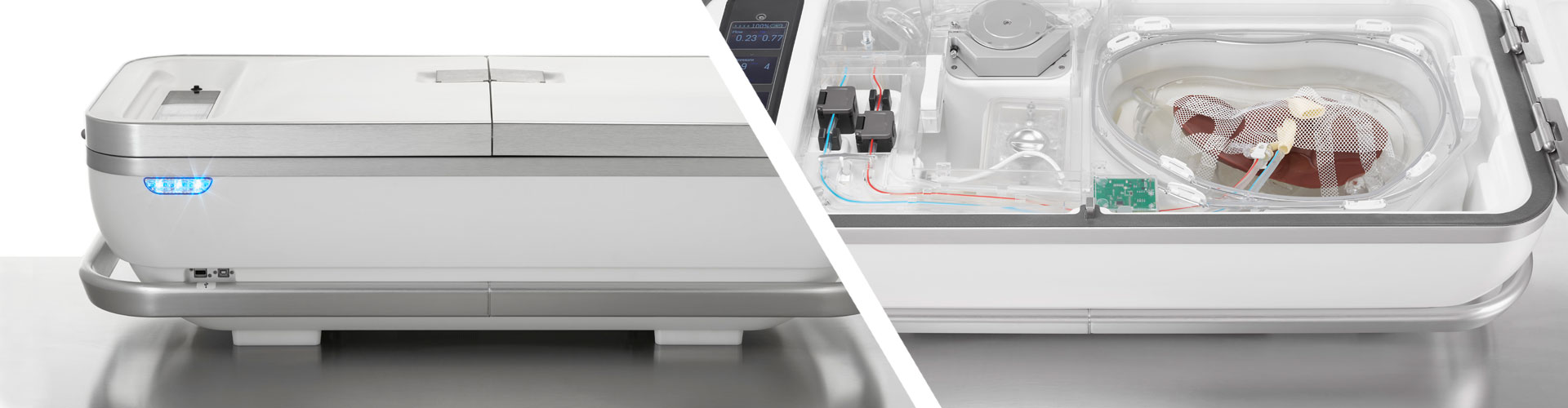 Hypothermic machine perfusion An alternative for organ preservation UNOS