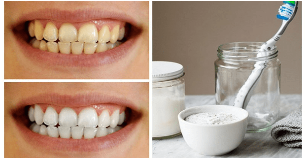 6 Ways to Prevent Coffee Stains on Teeth Unrealistic Trends
