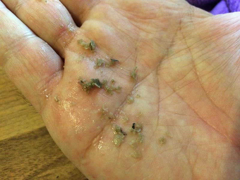 La Marzocco GS/3 total verkalkt wie kann ich sie wieder entkalken