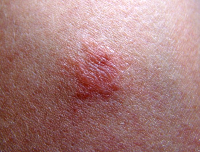 Liebe Neue, Bitte Kein Neues Thema Eröffnen, Sondern Hier Schreiben