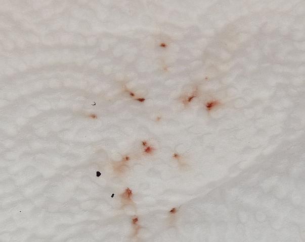 Schwarze sachen im Haar Katzen Forum