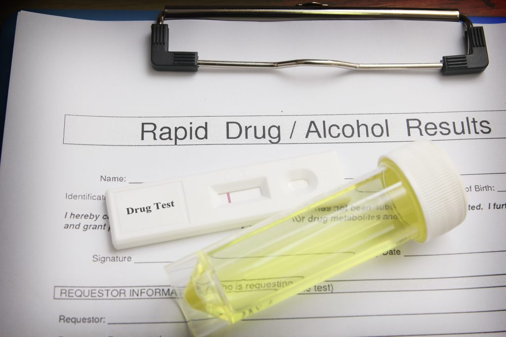Drug Testing in the Workplace Should Your Business Consider It