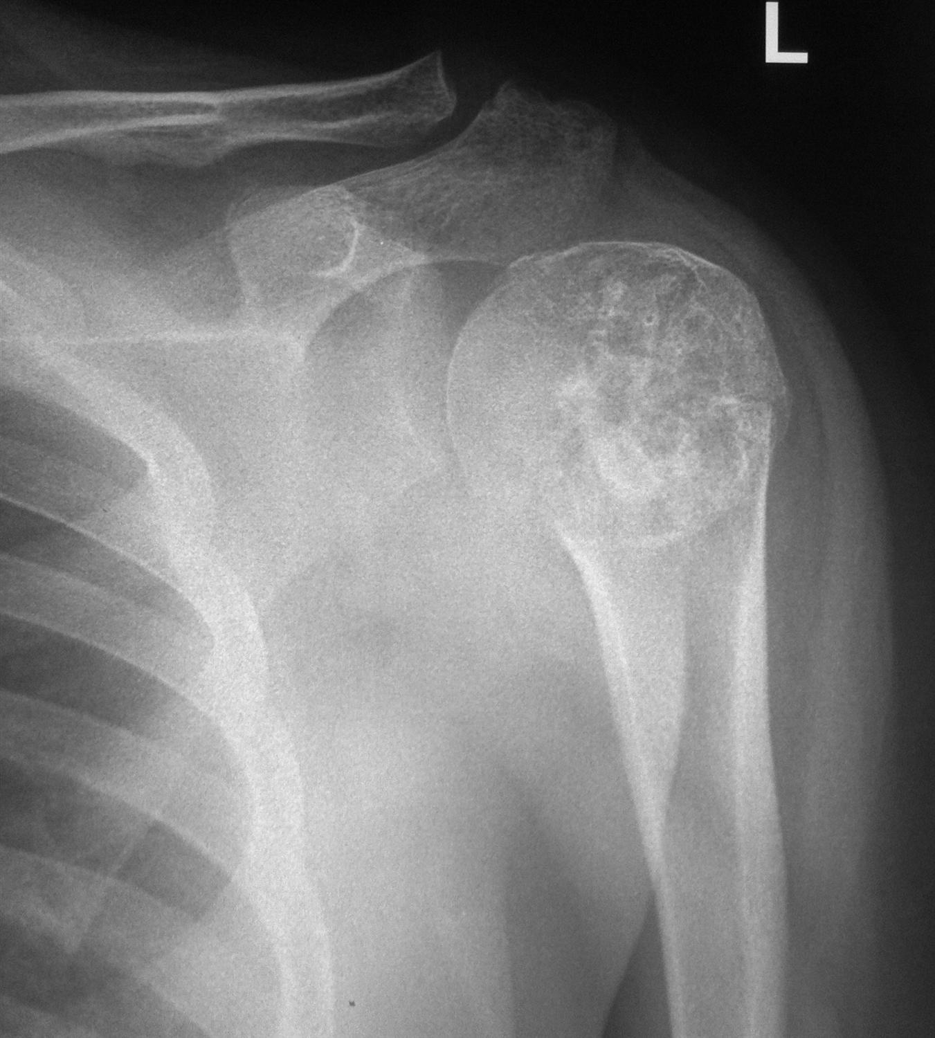 Differential Groups Pathology Orthobullets