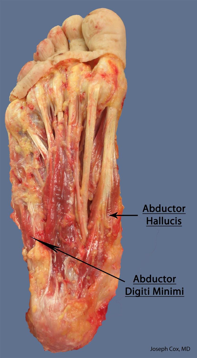 Abductor hallucis (MPN) Anatomy Orthobullets