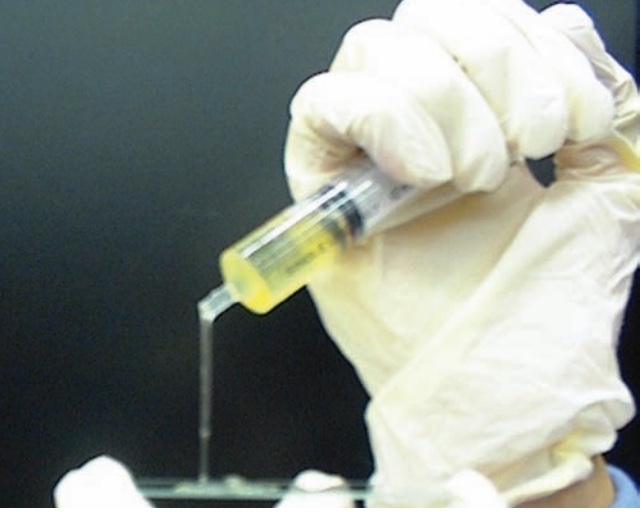 Septic Arthritis Adult Trauma Orthobullets